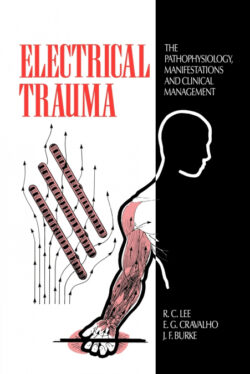 Libro Electrical Trauma    - KusiBooks