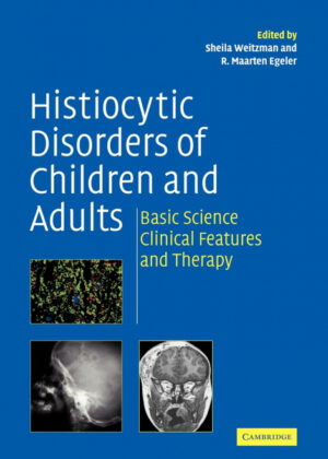 Histiocytic Disorders of Children and Adults <span>  </span>