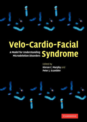 Velo-Cardio-Facial Syndrome <span>  </span>