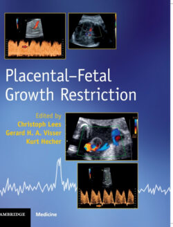 Libro Placental-Fetal Growth Restriction  Christoph Lees/Gerard H. A. Visser/Kurt Hecher  - KusiBooks