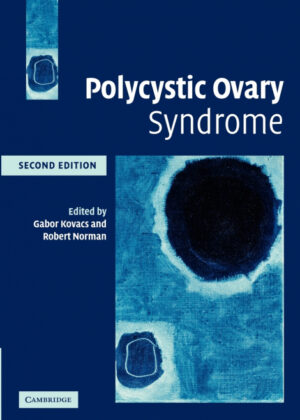 Libro Polycystic Ovary Syndrome <span>  </span> - KusiBooks