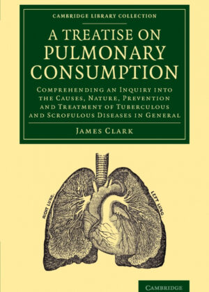 Libro A   Treatise on Pulmonary Consumption <span> James Clark </span> - KusiBooks